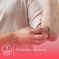 Минздрав Тувы предупреждает о случаях заболевания непривитых россиян краснухой