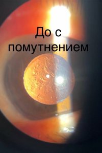 В ресбольнице Тувы внедрены новые методы лечения сложных глазных патологий