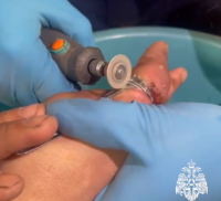 Спасатели Тувы освободили мужчину от сжимавшего палец кольца