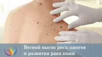 Жителей Тувы предупредили о рисках злокачественных образований под влиянием солнца